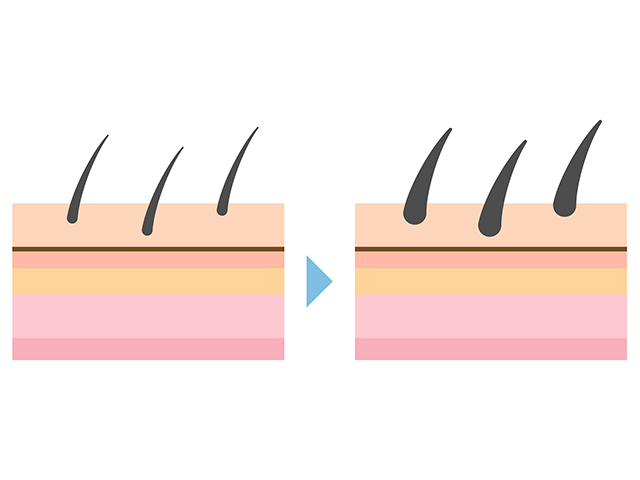 硬毛化や多毛化は毛の細胞の活性化が関係