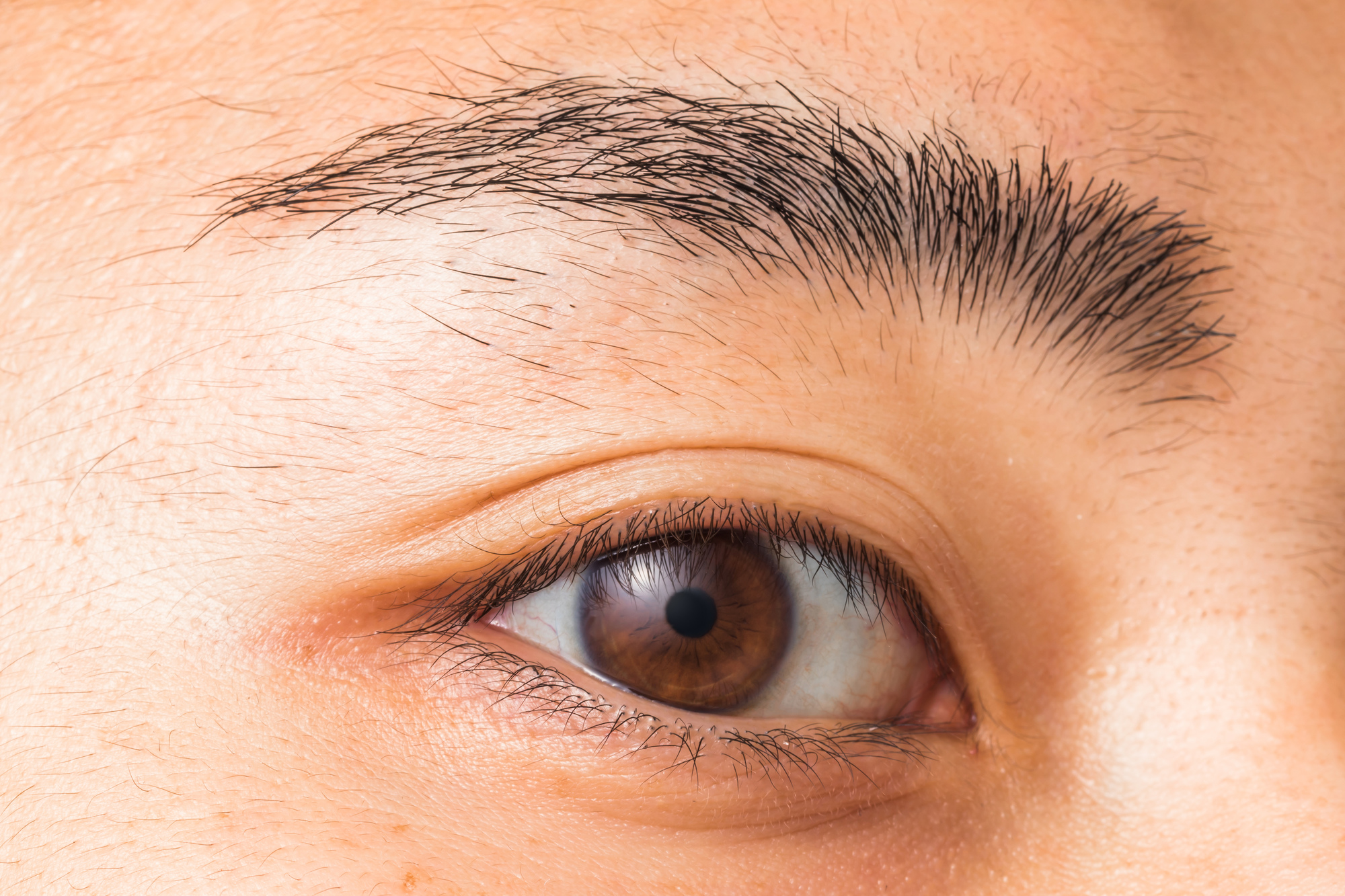 眉毛の美容電気脱毛（ニードル脱毛）とは？効果・回数・費用・デザイン例までわかる完全版